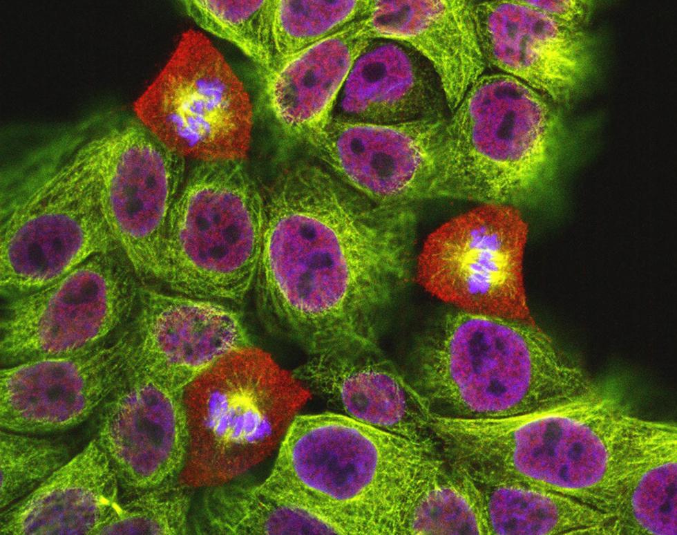 Mitotic cells